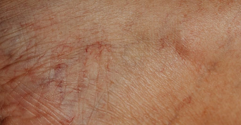 découvrez l'expertise des dermatologues pour des soins de la peau adaptés à vos besoins. profitez de conseils professionnels pour traiter l'acné, l'eczéma, le psoriasis et bien plus. prenez soin de votre santé cutanée avec des solutions sur mesure.
